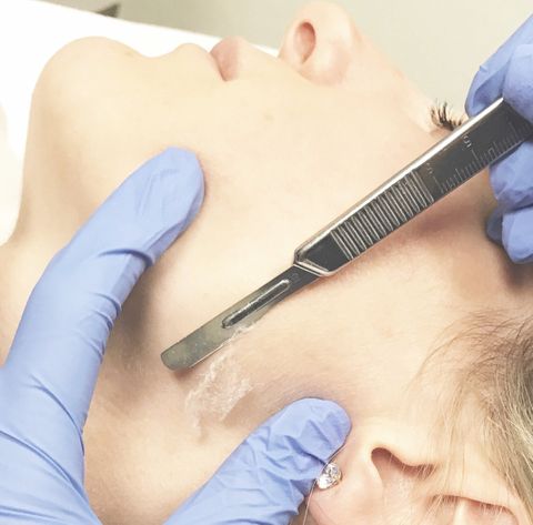 Dermaplaning Facial